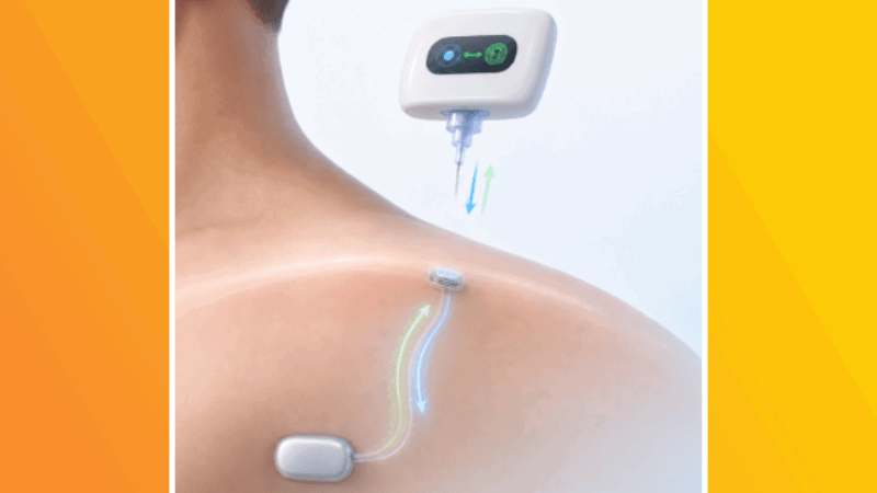 Graphic of a tissue-like implant inside a body
